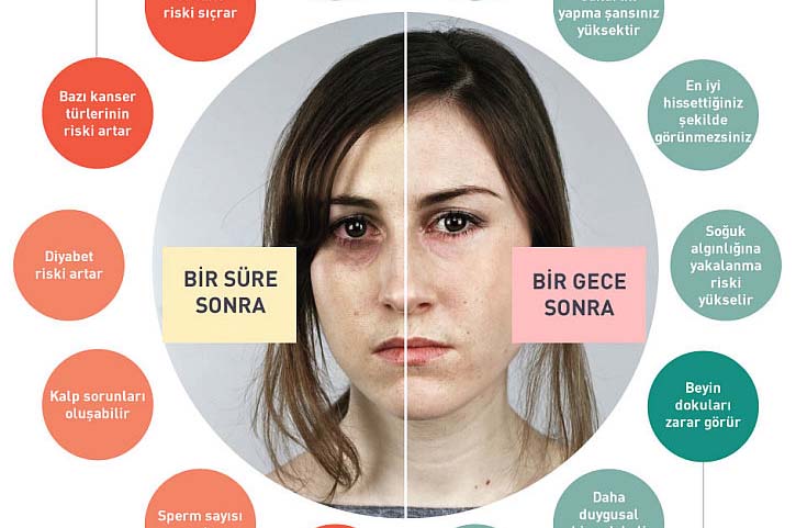 Uykusuzluk Sağlık Düşmanı